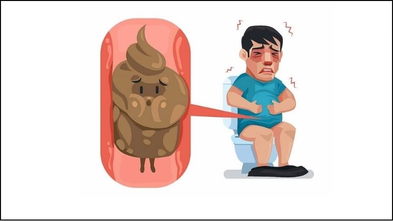 Táo bón mãn tính là nguyên nhân gây tắc ruột