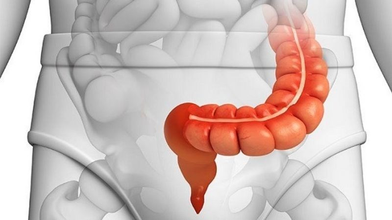 phẫu thuật điều trị xoắn đại tràng sigmoid