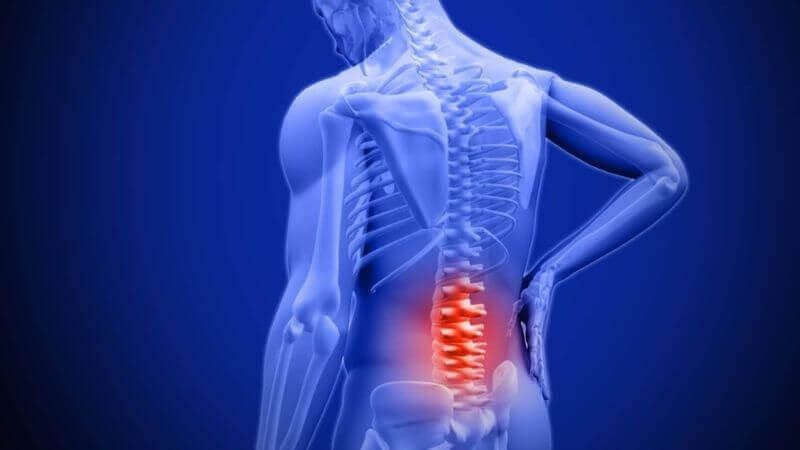 Đau lưng là một triệu chứng thường gặp của gai cột sống thắt lưng