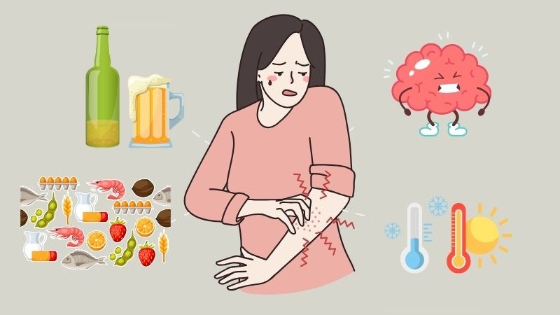 Người bệnh tế bào mast cần chú ý tránh xa các yếu tố khởi phát đợt cấp của bệnh