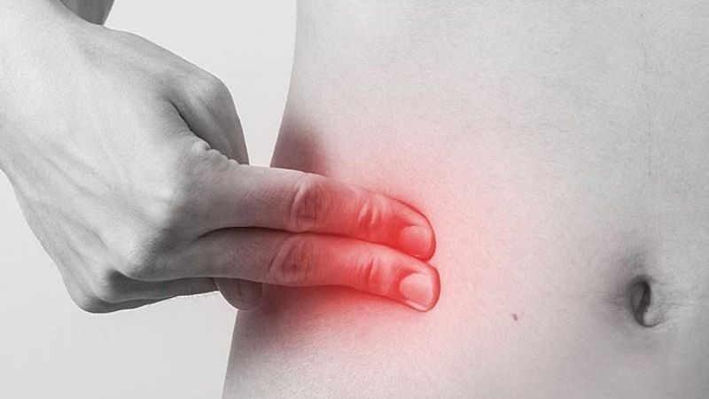 Viêm hạch mạc treo ruột là đau bụng ở góc tư dưới phải của bụng