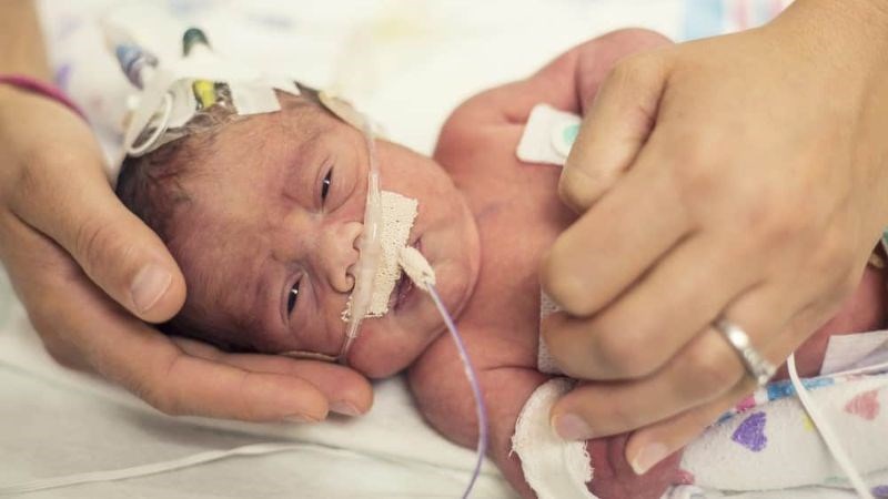 Trẻ bị viêm ruột hoại tử nặng cần được chăm sóc tại các đơn vị hồi sức sơ sinh Trẻ bị viêm ruột hoại tử nặng cần được chăm sóc tại các đơn vị hồi sức sơ sinh