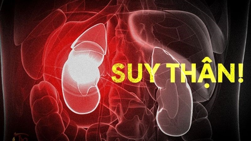 Bàng quang thần kinh có thể dẫn đến suy thận