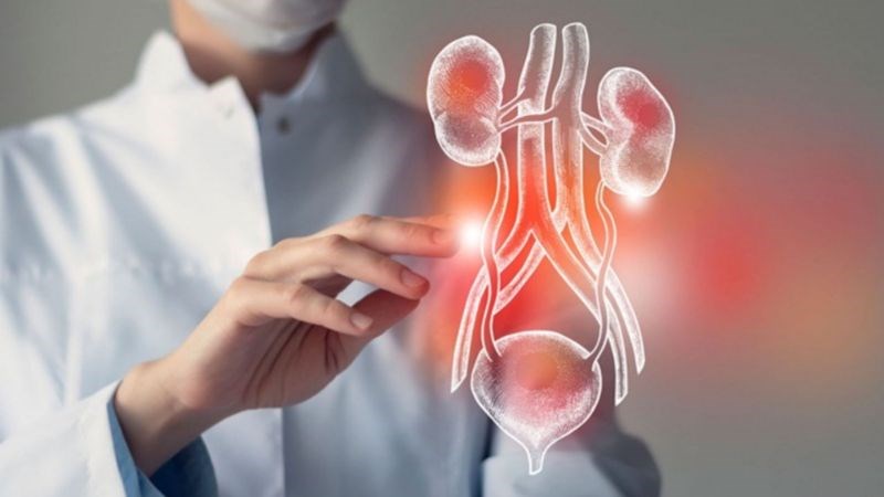 Đo niệu động học giúp đánh giá chức năng bàng quang
