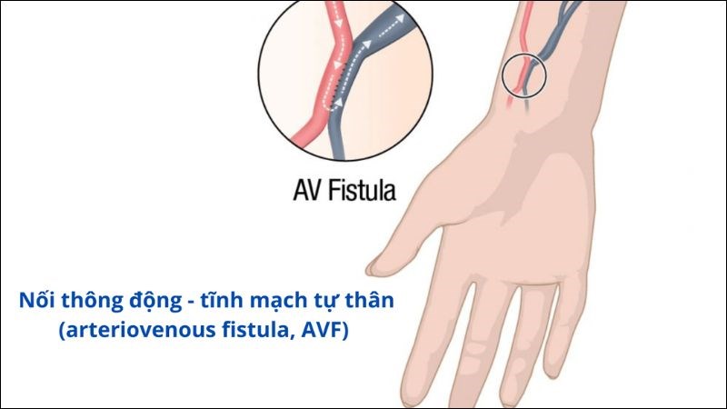 Cầu tay là một trong những đường vào của vi khuẩn