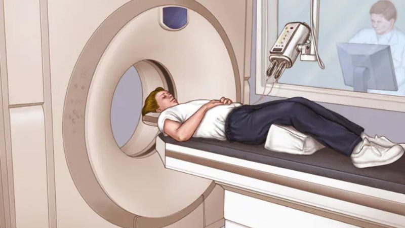 Chụp cắt lớp vi tính có thể thấy rõ bất thường trong cấu trúc não