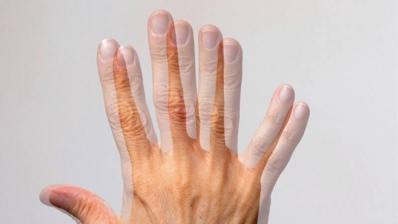 Khi chấn thương sọ não có thể xuất hiện nhìn đôi