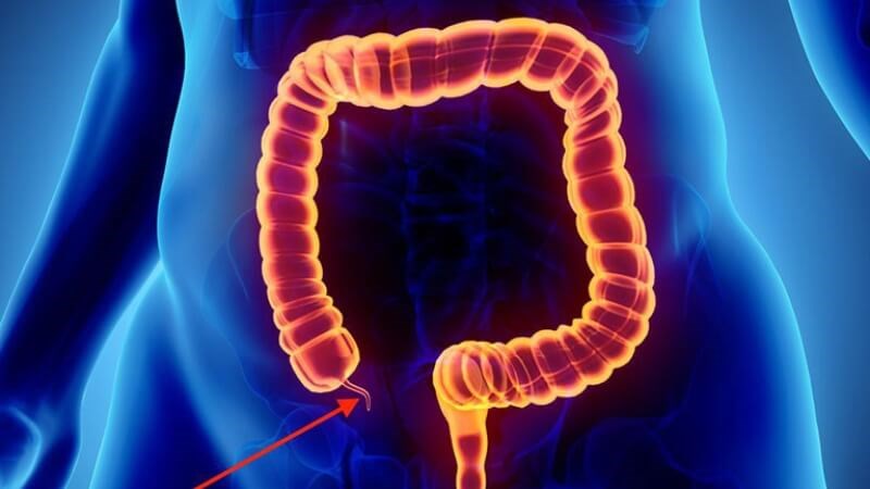 Nôn mửa kéo dài có thể là dấu hiệu của viêm ruột thừa