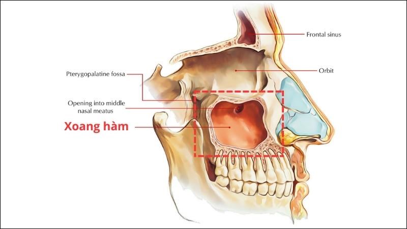 Viêm xoang hàm và cách điều trị bằng thuốc