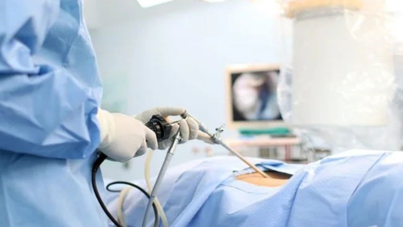 Có thể điều trị nang gan bằng mổ nội soi