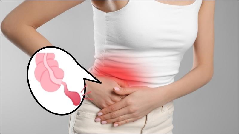 Viêm ruột thừa cấp thừa biểu hiện triệu chứng đau bụng vùng bụng dưới bên phải