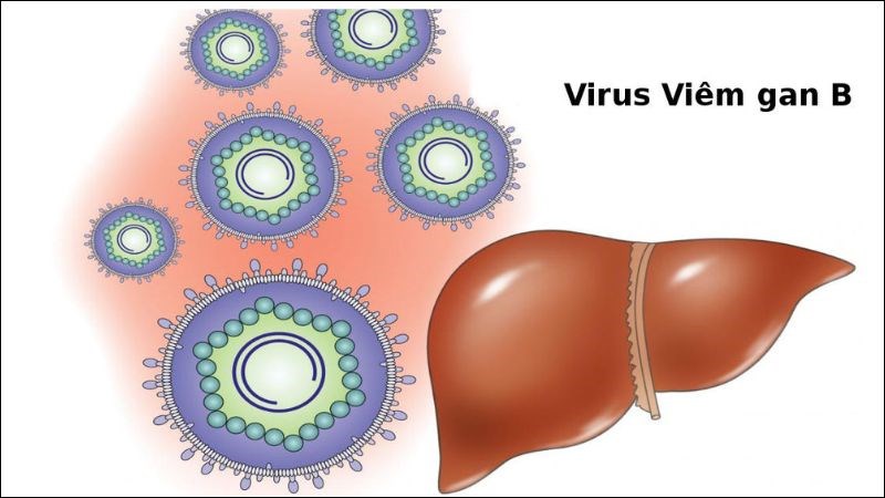 Viêm gan B là một trong những nguyên nhân gây nên viêm gan mạn tính