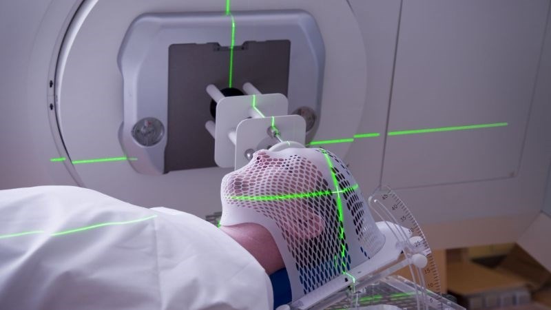 Xạ trị được lựa chọn phổ biến trong điều trị ung thư vòm hầu Xạ trị được lựa chọn phổ biến trong điều trị ung thư vòm hầu