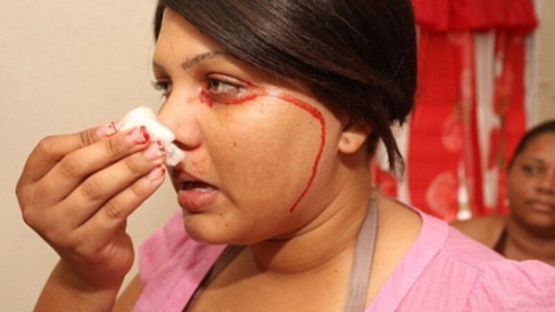 Mồ hôi máu có thể xuất hiện ở tất cả các bộ phận trên cơ thể