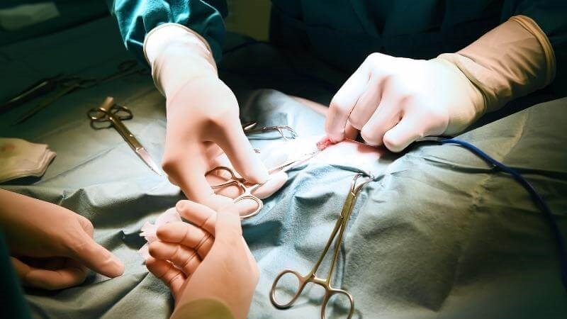 Phẫu thuật được xem là phương pháp hiệu quả nhất khi bao quy đầu quá hẹp