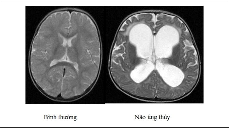 Có thể pháp hiện bệnh qua các xét nghiệm hình ảnh