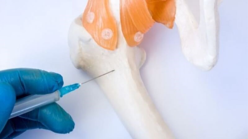 Tủy đồ được xem là tiêu chuẩn vàng trong chẩn đoán suy tủy xương Tủy đồ được xem là tiêu chuẩn vàng trong chẩn đoán suy tủy xương