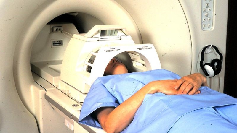 chụp cộng hưởng từ MRI để xác định rõ hơn tình trạng não bộ