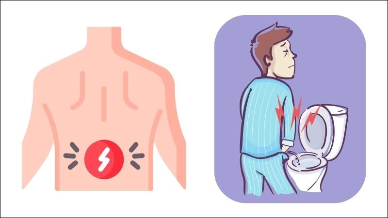 Hỏi bệnh sử chủ yếu dựa trên triệu chứng đau vùng thắt lưng và tiểu khó