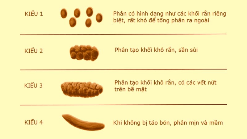 Trẻ bị táo bón thường đi tiêu ra phân kiểu 1 và 2