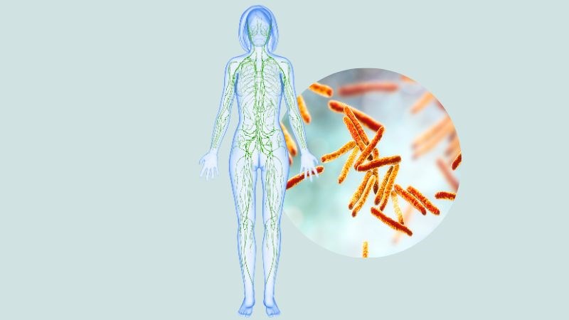 Vi khuẩn lao có thể lan tràn khắp cơ thể và đến màng bụng theo đường bạch huyết