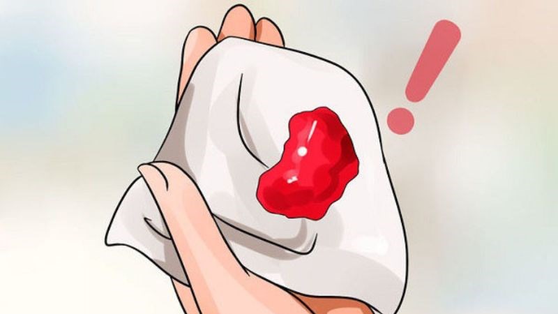 Khi xuất hiện ho ra máu nên đến các cơ sở y tế để được thăm khám