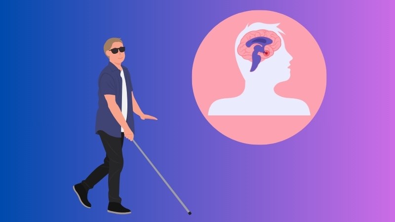 Ung thư tuyến yên có thể gây ra biến chứng mù lòa vĩnh viễn