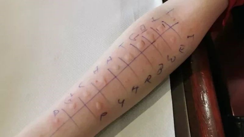 Sẽ mất tầm 1 giờ để hoàn thành xong bài test lẩy da