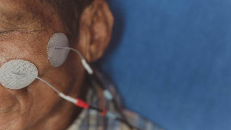 Liệt dây thần kinh số bảy cũng được xem là một trong những nguyên nhân gây tê mặt
