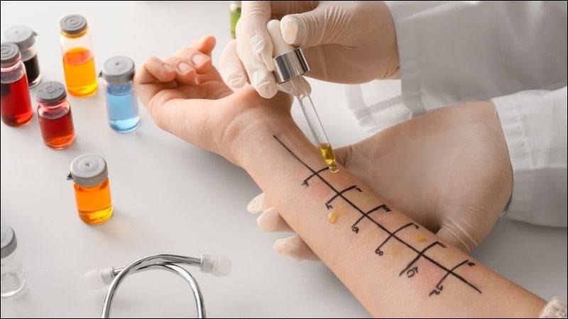 Xét nghiệm kiểm tra dị ứng giúp bác sĩ tìm hiểu nguyên nhân của chảy nước mũi