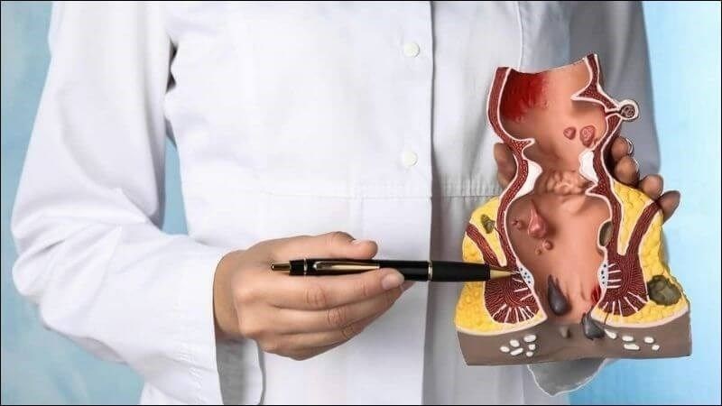 Gặp bác sĩ nếu đau hậu môn kèm với ổ áp xe, trĩ hoặc khối u