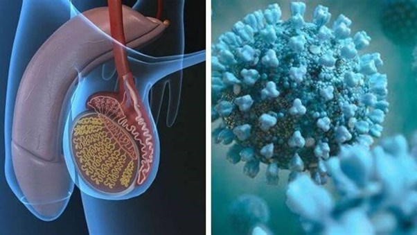 Viêm tinh hoàn Viêm tinh hoàn