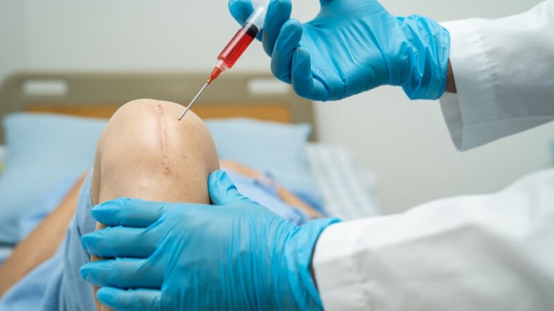 Tiêm nội khớp thuốc steroid để giảm tình trạng viêm khớp