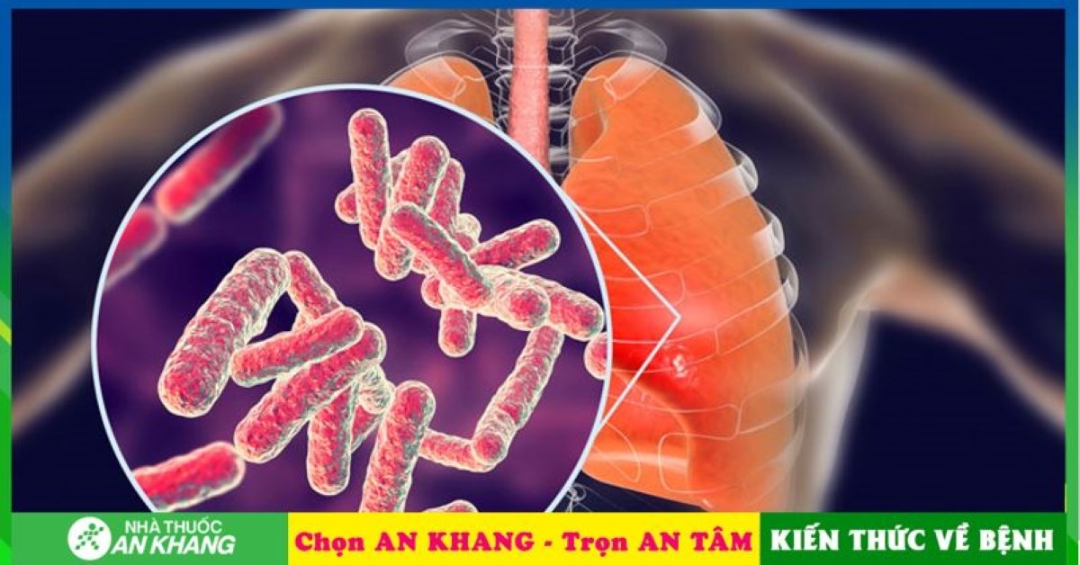 Cách bệnh lao phổi lây lan qua đường hô hấp là gì?
