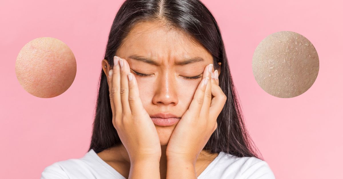 Gợi ý cách chăm sóc da mặt khô tại nhà cho mẹ làn da mịn màng hơn