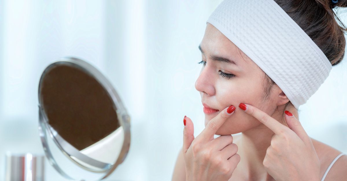Gợi ý cách chăm sóc da mặt sau khi nặn mụn giúp làm sạch da chuẩn nhất