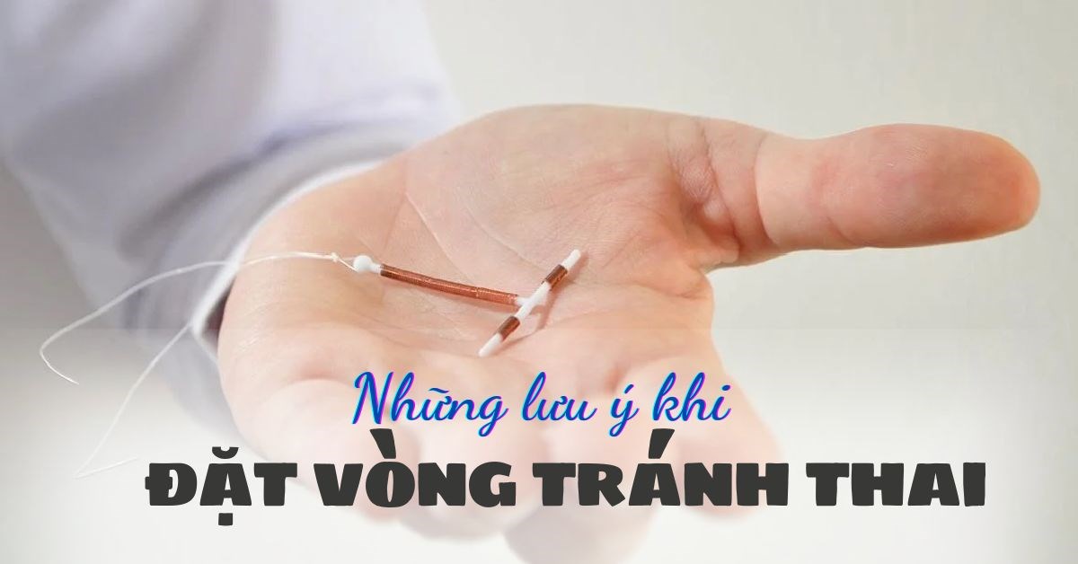 Đặt vòng tránh thai: lợi ích và những lưu ý