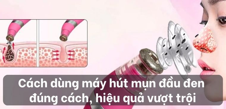 Cách dùng máy hút mụn đầu đen đúng cách, hiệu quả vượt trội