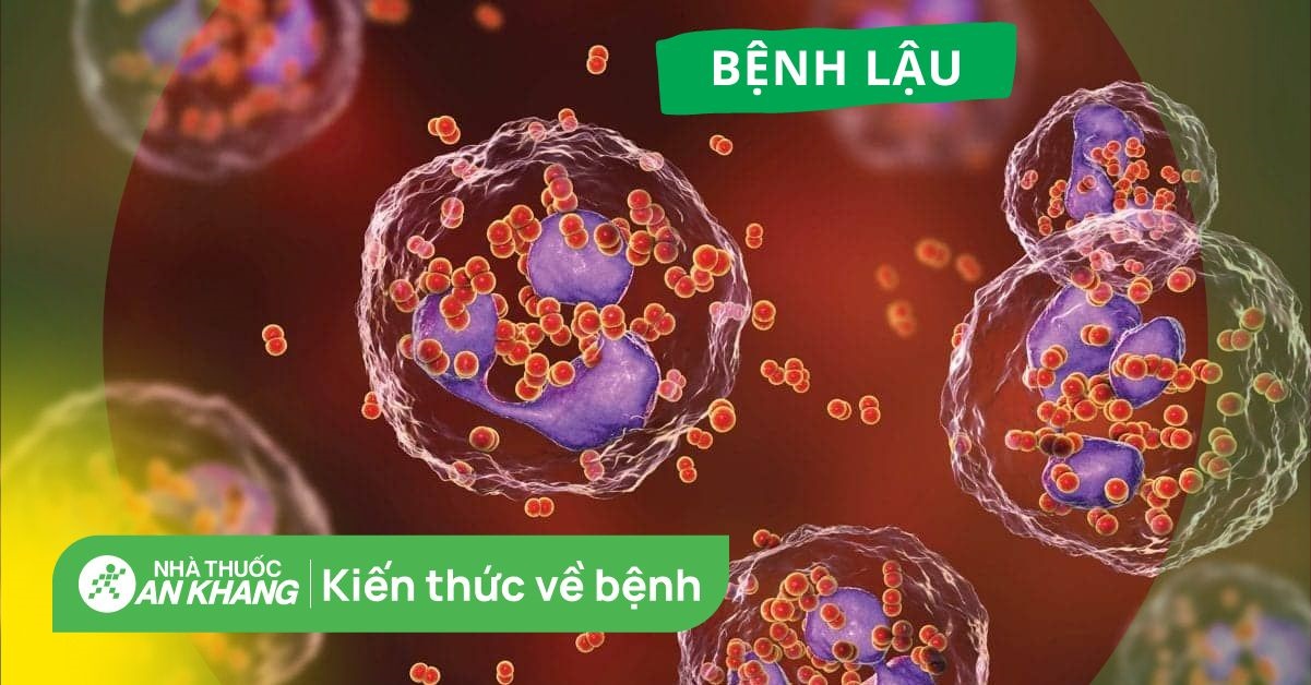 Bệnh lậu là gì? Biểu hiện của bệnh lậu và cách phòng ngừa