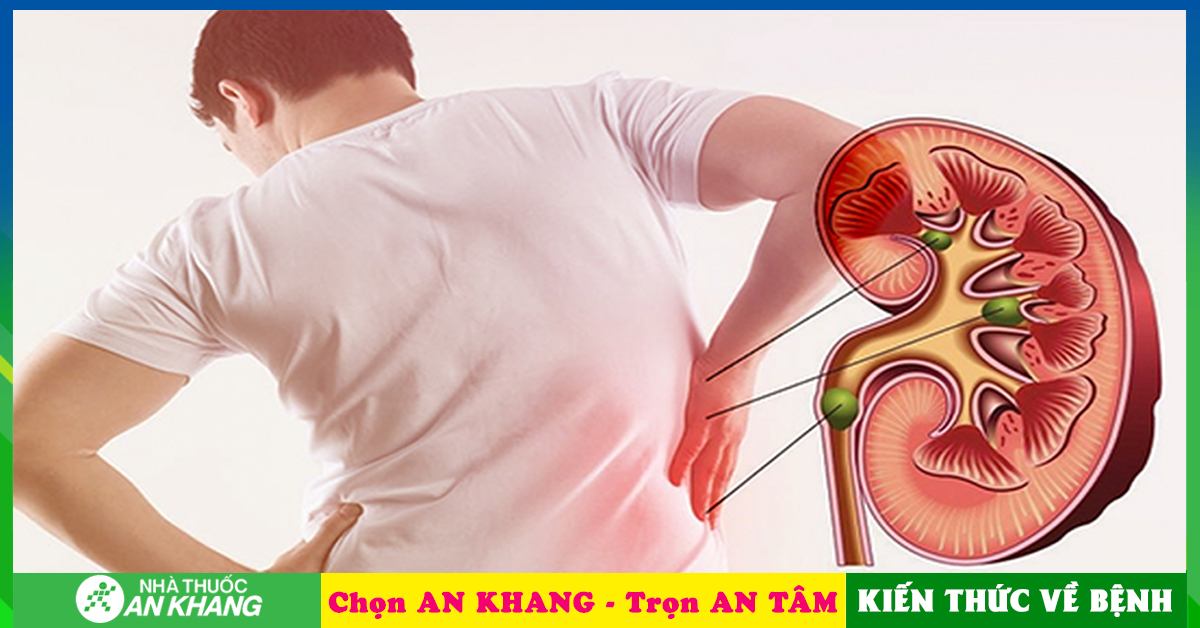 Cách chữa trị sỏi thận tại nhà có hiệu quả không?
