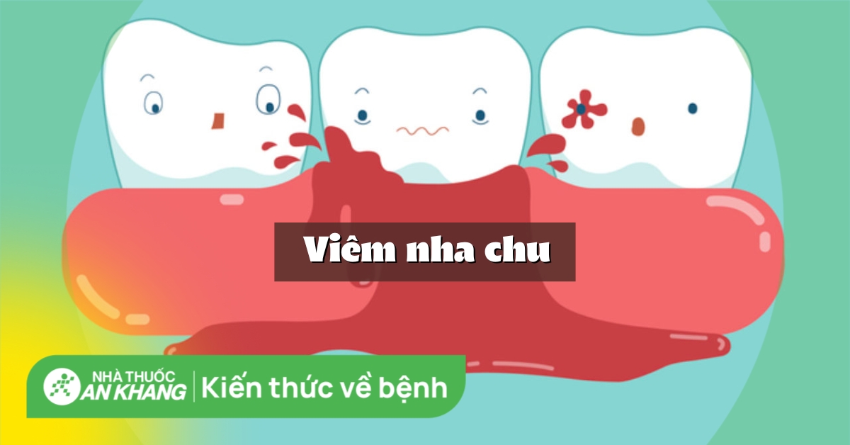 Viêm nha chu có thể gây tổn thương nào cho răng và làm ảnh hưởng đến sức khỏe miệng?