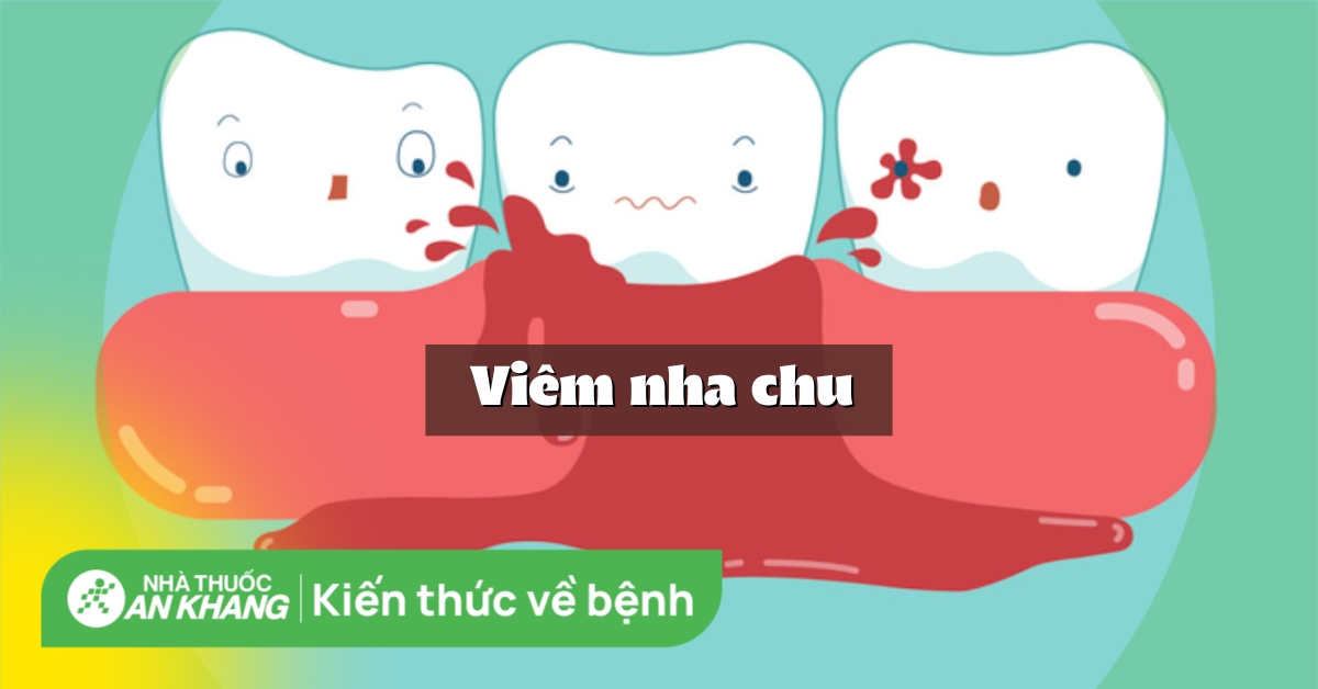 Triệu chứng của viêm nha chu là gì?
