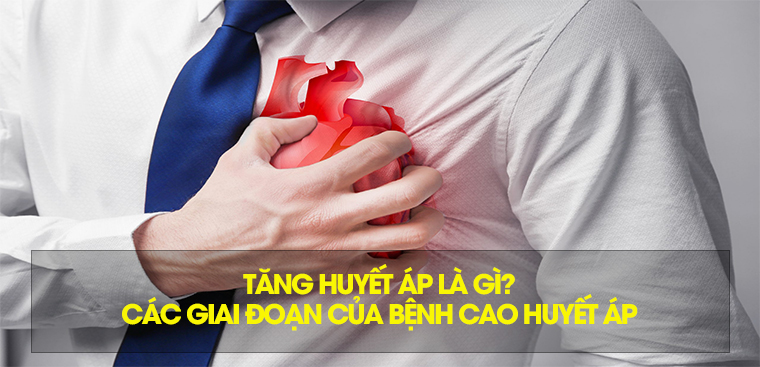Tăng huyết áp là gì? Các giai đoạn của bệnh cao huyết áp