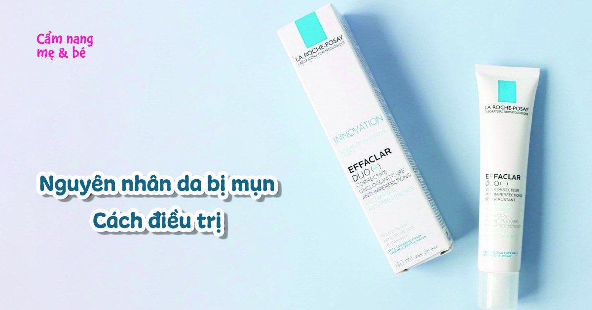 Nguyên nhân gây mụn phổ biến, cách điều trị trên từng vùng da mặt