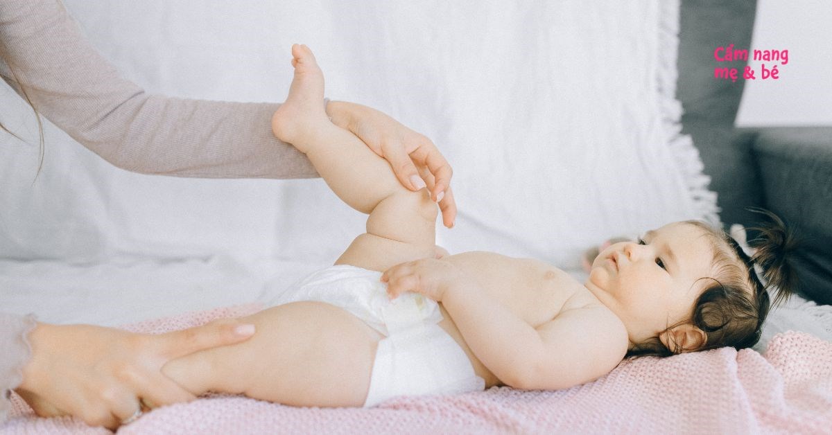 Trẻ bị hăm có nên đóng bỉm? Hướng dẫn cách mặc bỉm đúng khi trẻ bị hăm