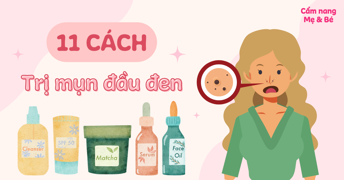 11 cách trị mụn đầu đen tại nhà nhanh chóng, hiệu quả