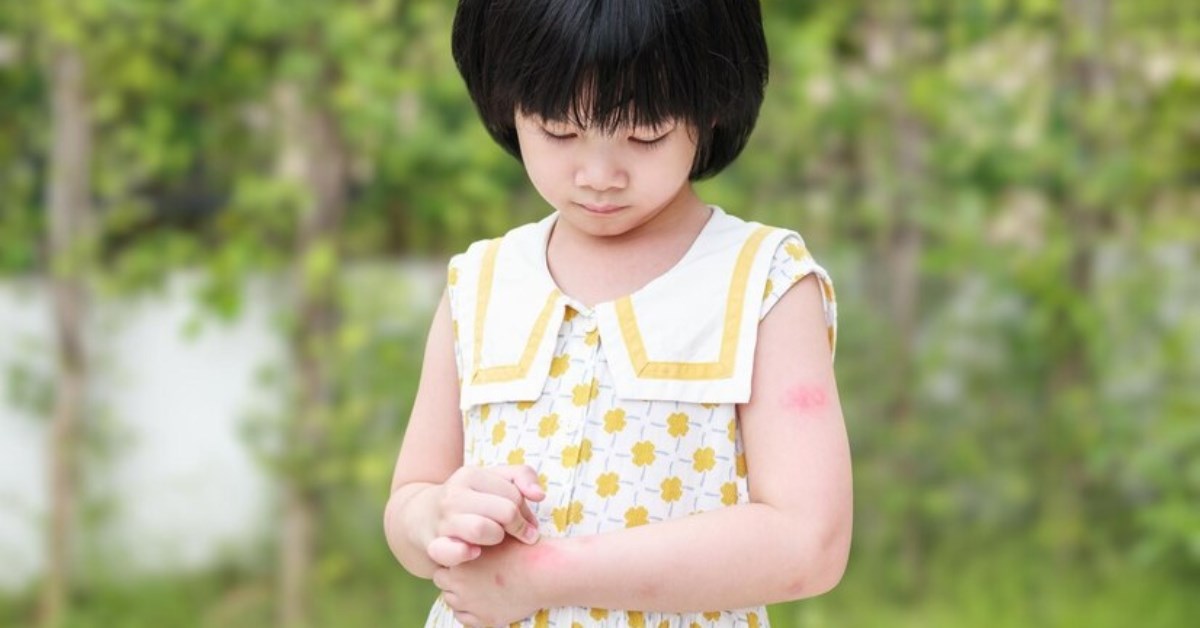 Một số bệnh dị ứng ở trẻ em thường gặp và cách chăm sóc an toàn