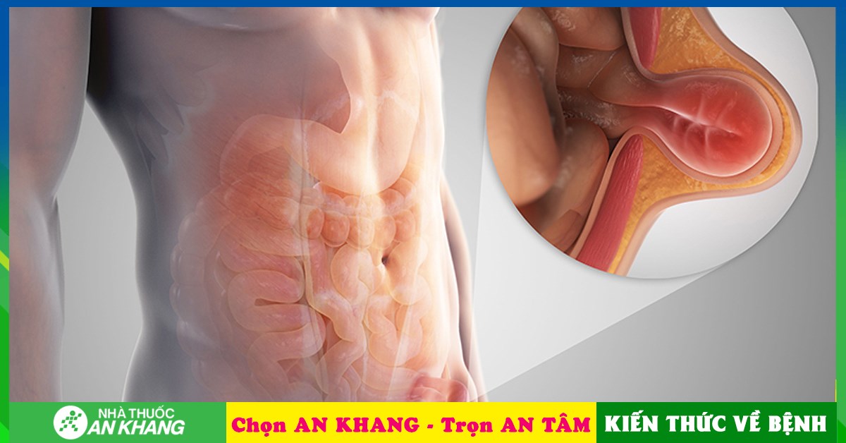 Phương pháp điều trị ung thư tinh hoàn bạn nên biết
