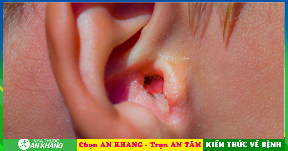 Tại sao viêm ống tai ngoài cần được điều trị?
