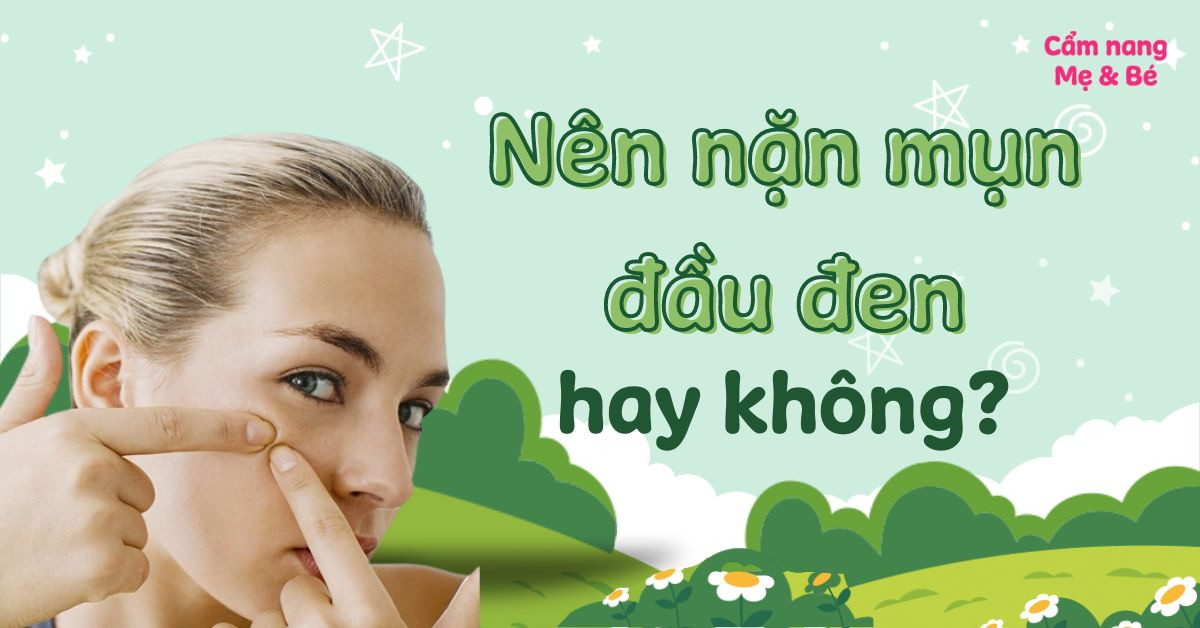 Có nên nặn mụn đầu đen không? Cách nặn tại nhà an toàn cho da